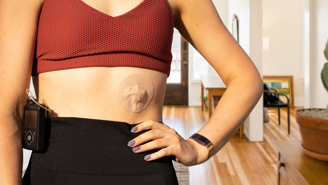 How CGM Users Are Preventing Skin Burn: Community Hacks That Work