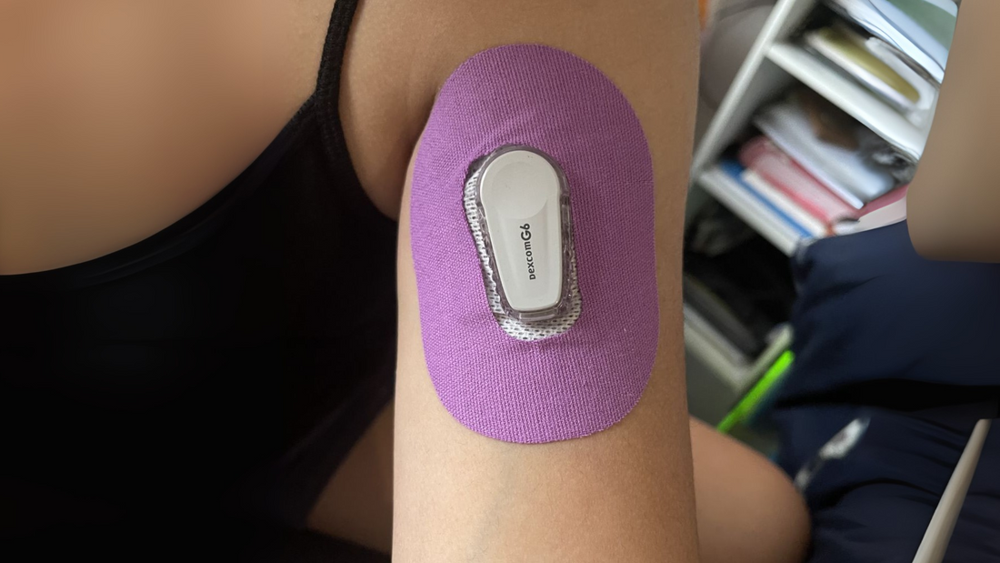 How to make sure your CGM patch is actually hypoallergenic