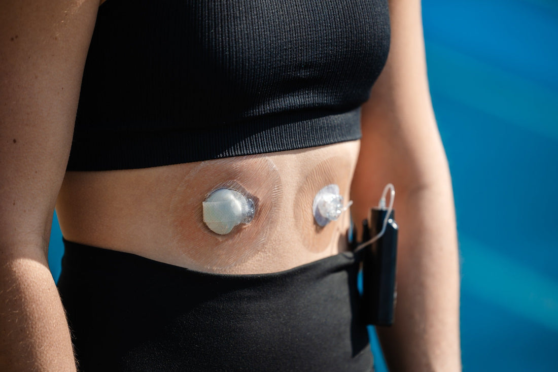 Benefits of upgrading to the Dexcom G7 - Type Strong