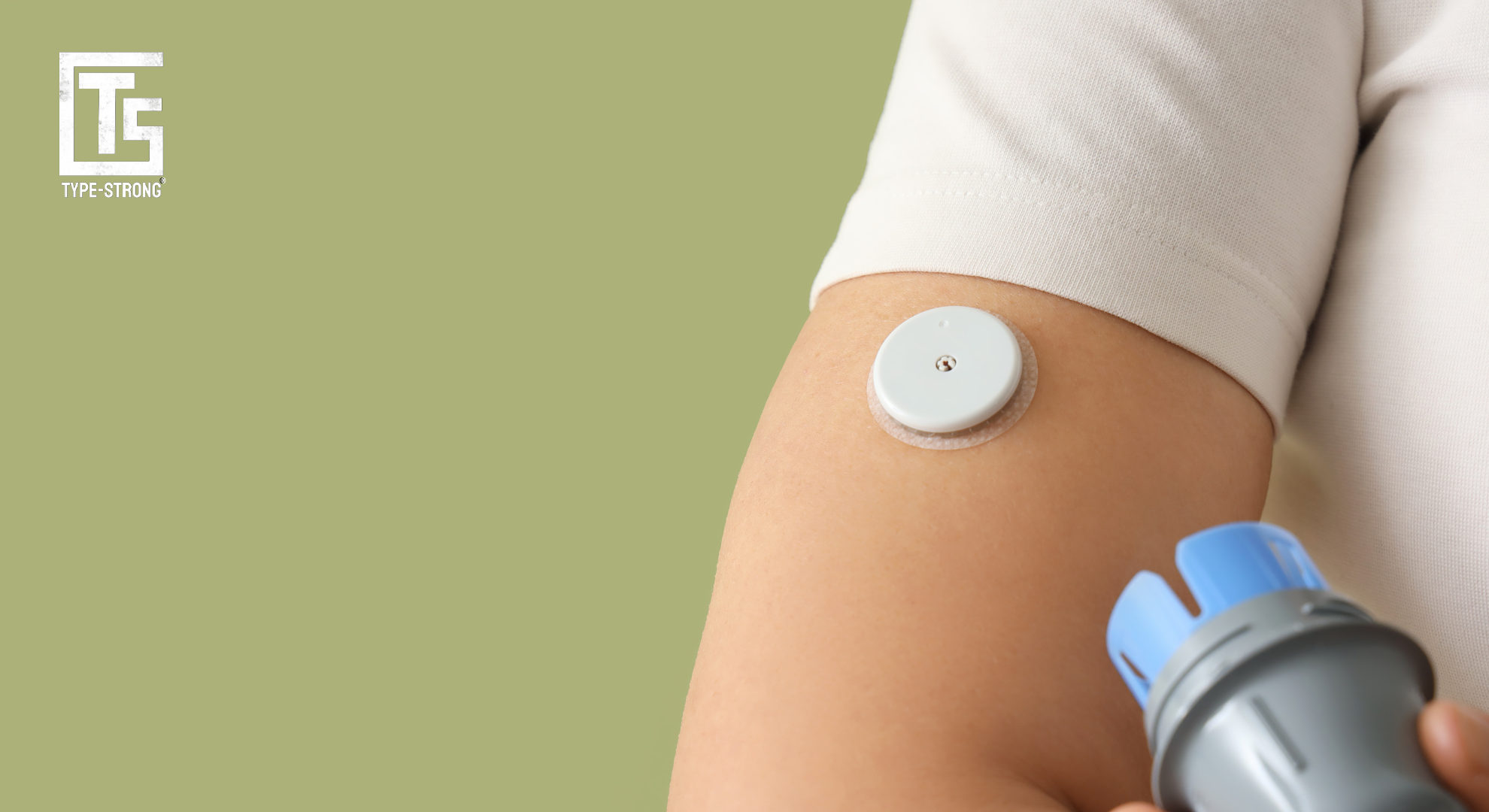CGM placement guide: Where to wear your sensor for accurate readings
