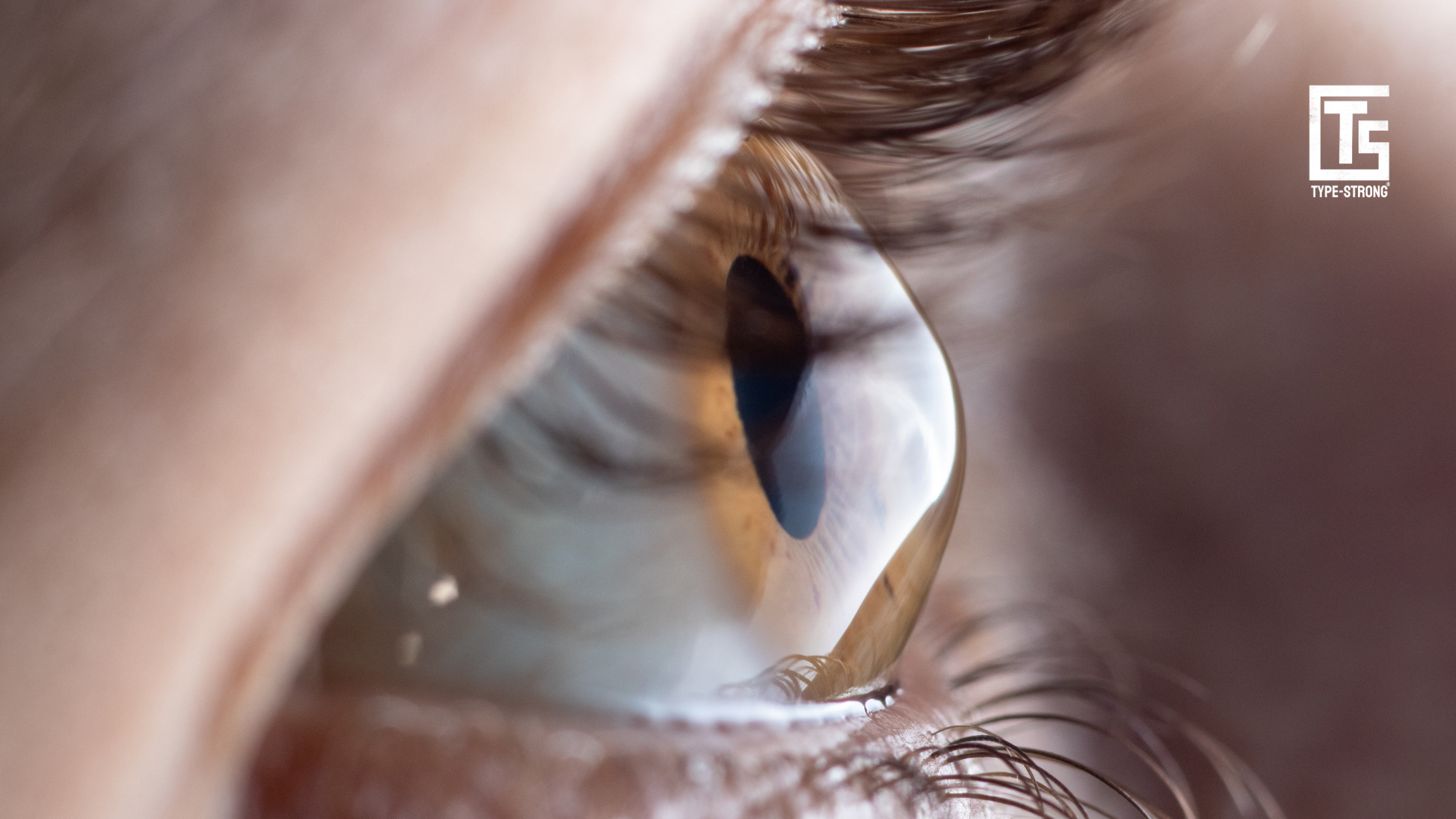 High glucose triples eye-disease risk: the checks you should book now