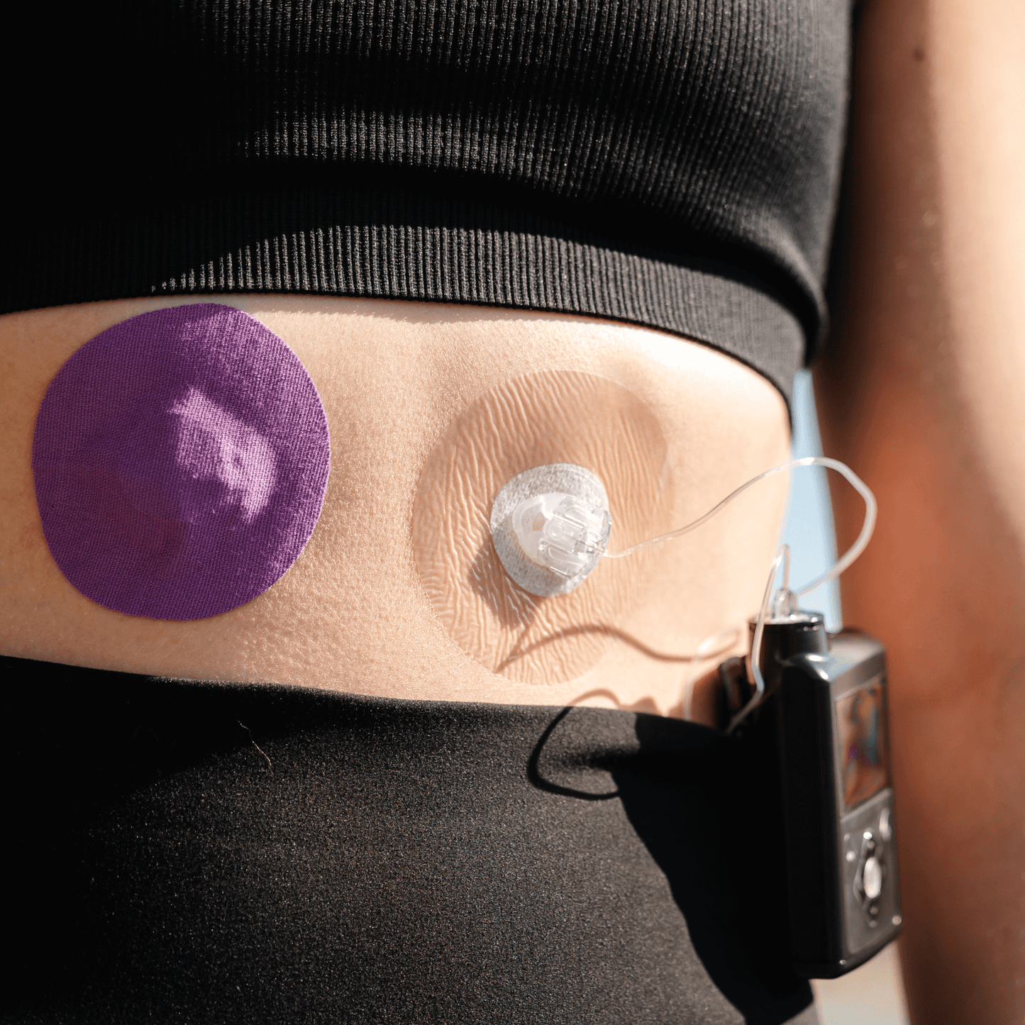 Pump Infusion Set Patches